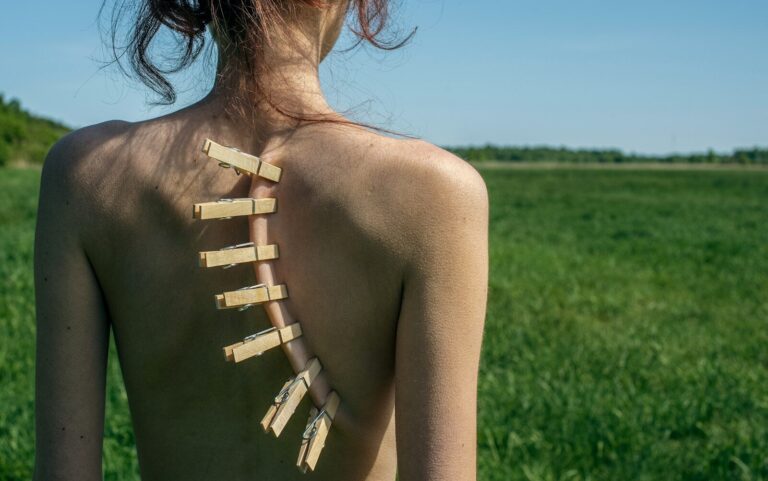 Clothespins attached to a bare back in a field.