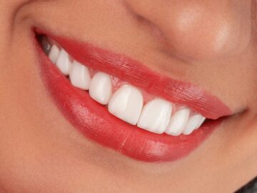 Close-up of a woman's smiling mouth with red lipstick.